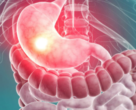 SMP Gastroenterology and Hepatology